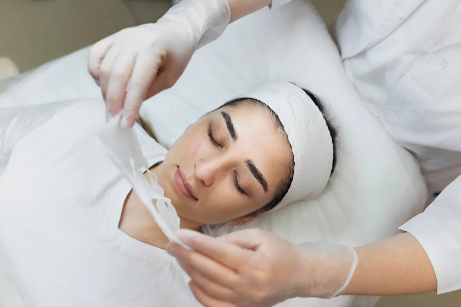 Chemical peel illustration