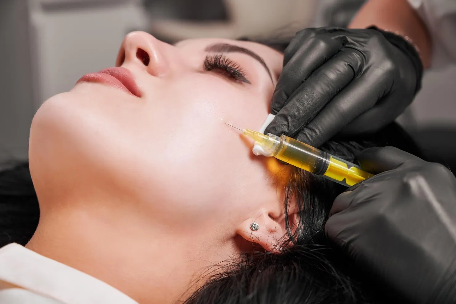 Mesotherapy illustration
