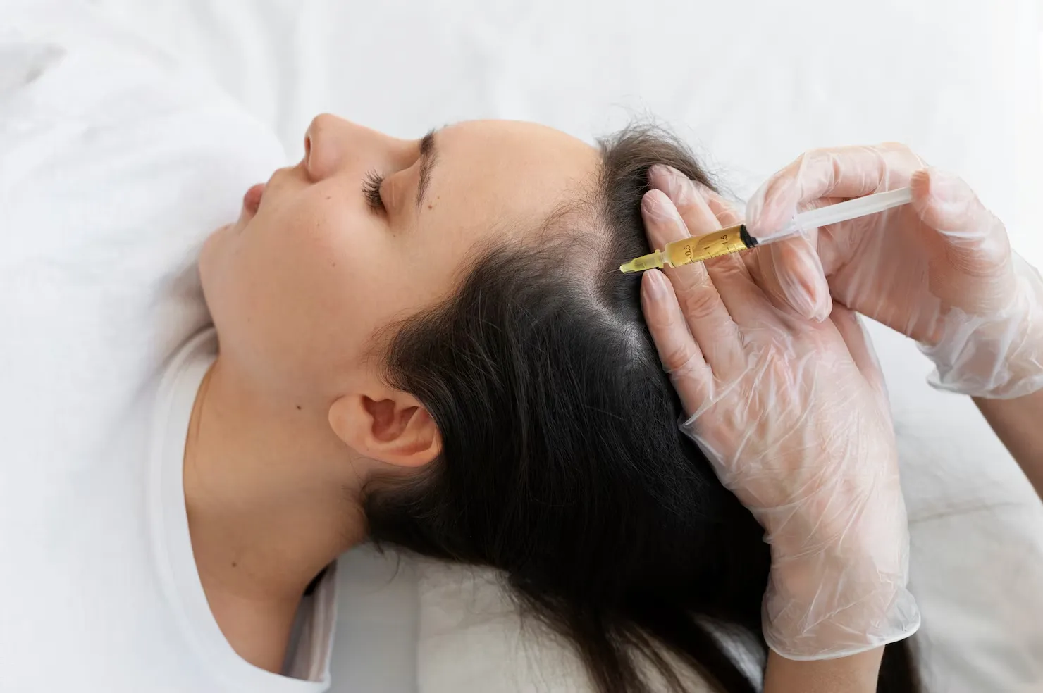 PRP therapy illustration