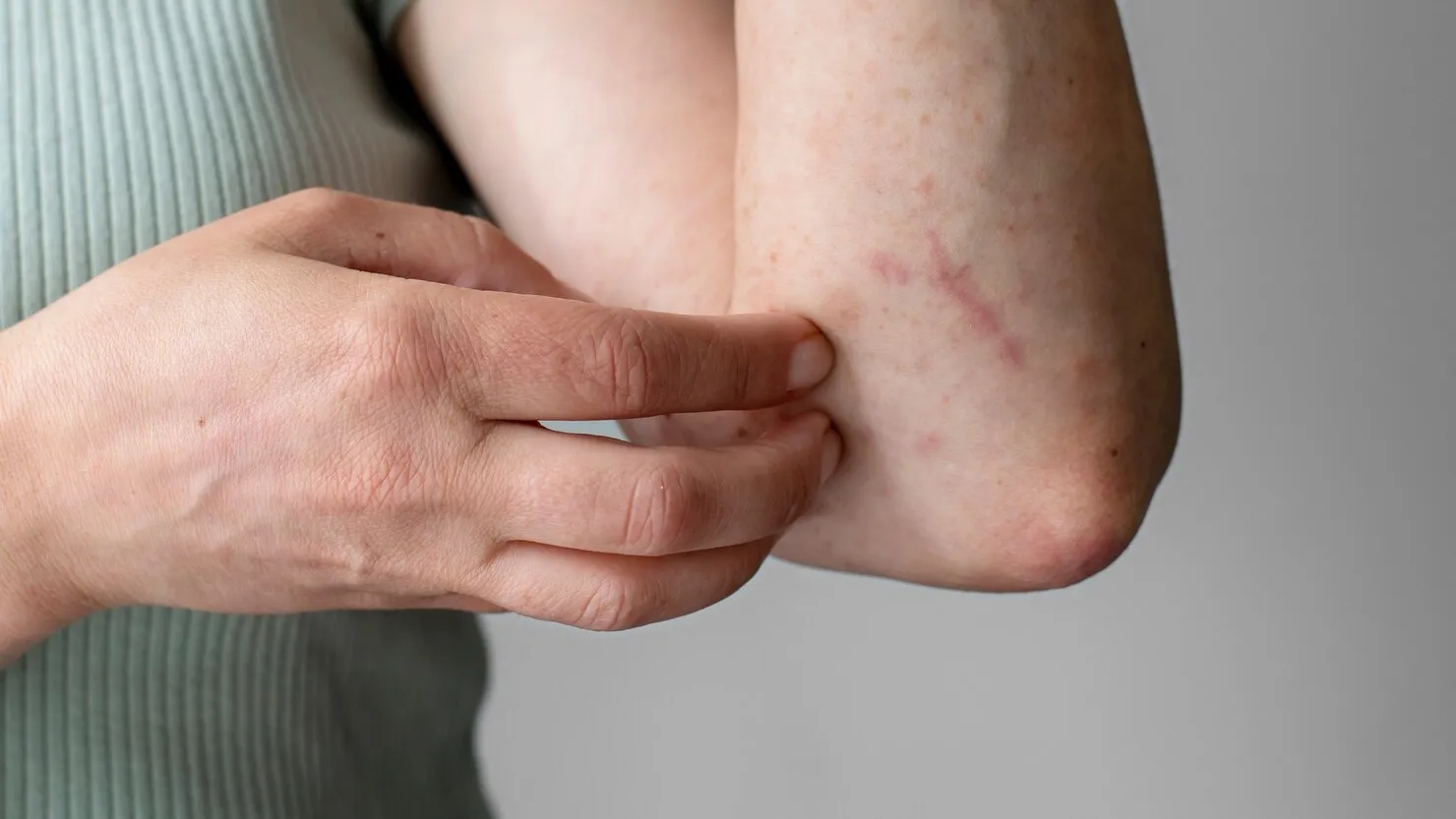 Skin allergy care illustration